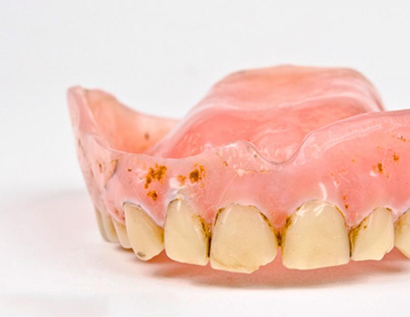 Какие средства будут эффективны для чистки зубных протезов? Как ухаживать и чистить съемные зубные протезы в домашних условиях и нужно ли их снимать на ночь? Уход за протезированными зубами