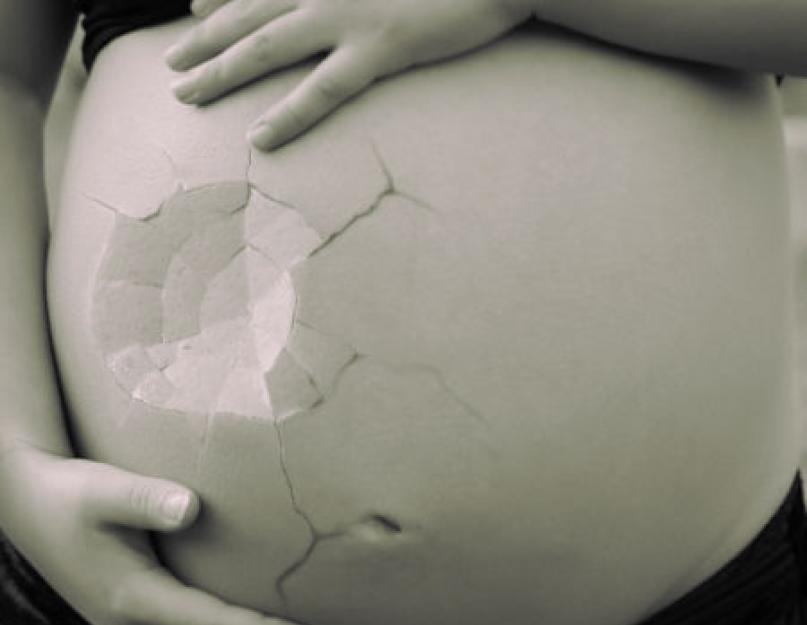 Polütsüstilised munasarjad ja raseduse planeerimine: kas on võimalik rasestuda.  Polütsüstilised: rasestumisvõimalused Kas polütsüstilised munasarjad mõjutavad lapse tervist