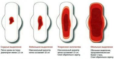 Väga nappide menstruatsioonide põhjused vähese verega