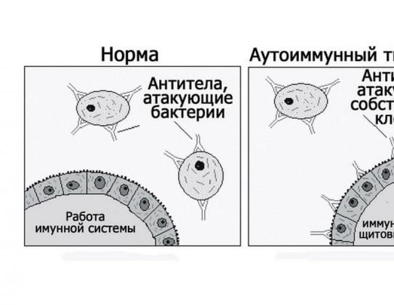 Аутоиммунный тиреоидит что это симптомы лечение. Аутоиммунные антитела щитовидной железы. Аутоиммунный тиреоидит что это симптомы лечение. Аутоиммунный тиреоидит щитовидной железы (аит). Аутоиммунный тиреоидит(аит), гипотиреоз.