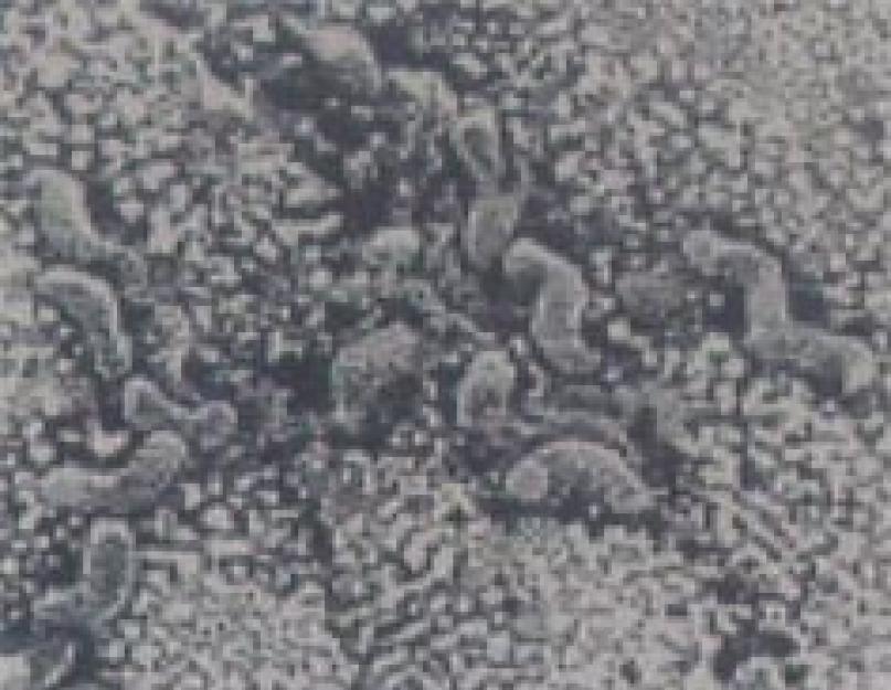 Диагностика инфекции Нelicobacter pylori. Хеликобактер пилори - симптомы и лечение Хромоскопия в эндоскопии