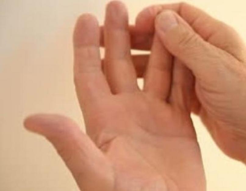 क्या करना है उंगली पर हड्डी।  उंगलियों के जोड़ों पर धक्कों के उपचार की विशेषताएं।  प्रकार और लक्षण