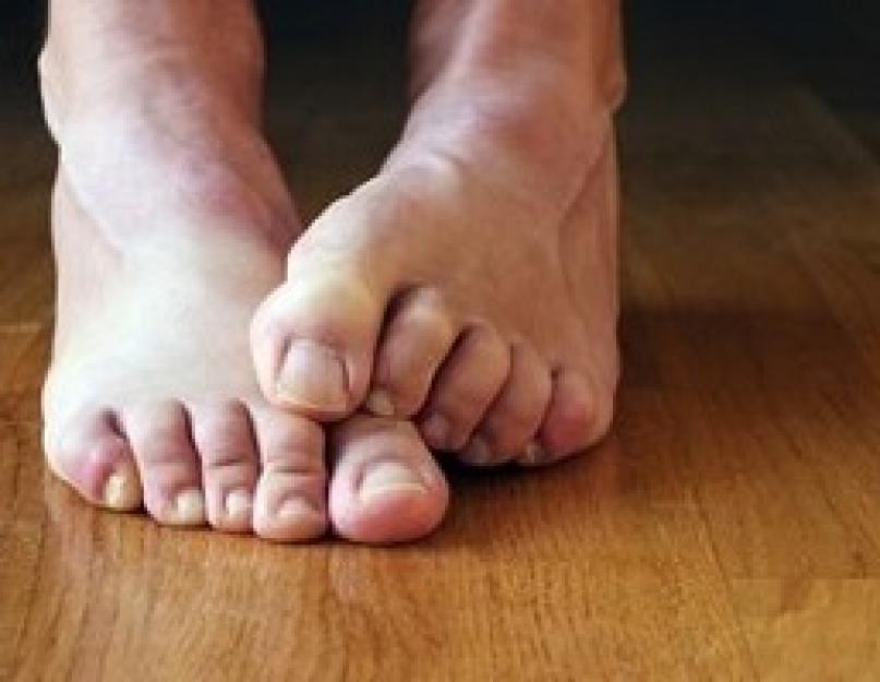बड़े पैर के अंगूठे में दर्द का इलाज कैसे करें।  बड़े पैर के जोड़ में दर्द होता है: इलाज कैसे करें, दर्द के कारण, उपचार के तरीके।  रोगों का निदान और दर्द का खात्मा