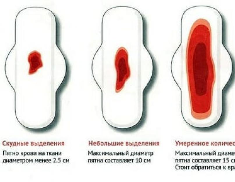 2 kuud kesised perioodid.  Väga nappide menstruatsioonide põhjused vähese verega.  Munasarjade talitlushäired
