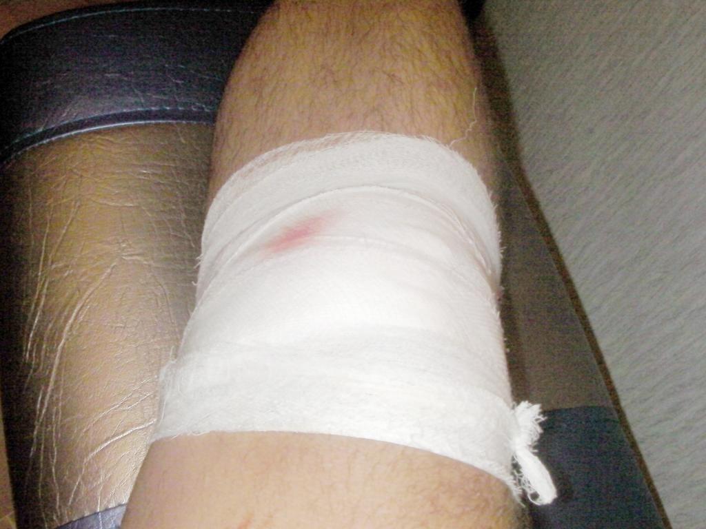 Болит рана на колене