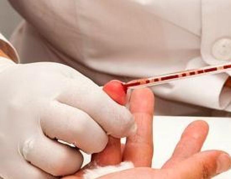 रक्त परीक्षण पैरामीटर डिकोडिंग।  सामान्य रक्त परीक्षण क्या दिखाता है: डिकोडिंग, मानदंड