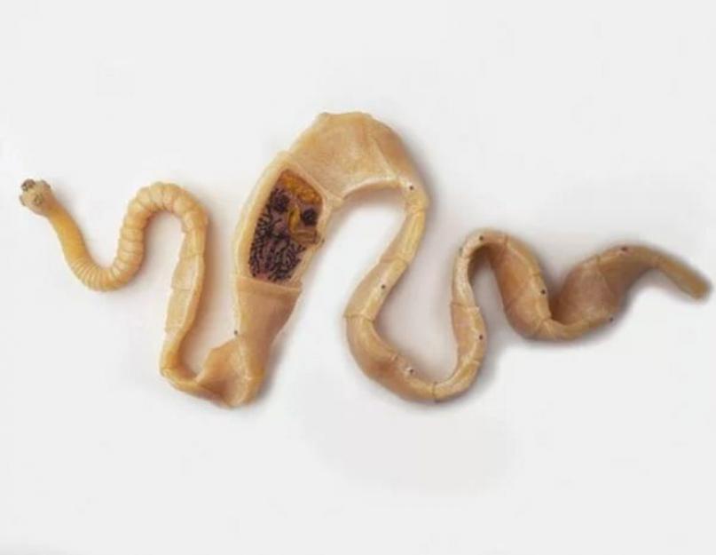 Ленточный червь в кишечнике. Симптомы и лечение ленточных глистов у человека
